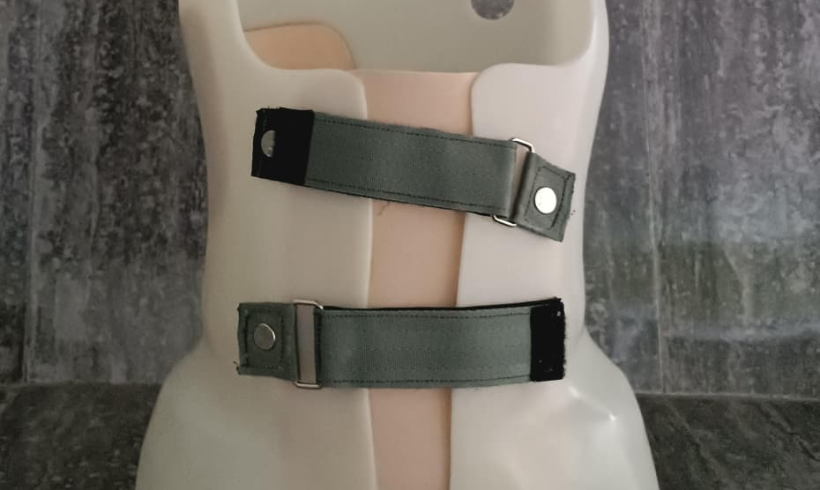 Wujudkan Harapan Pasien untuk Kembali Bergerak : RSUD Raja Ahmad Tabib Sediakan Layanan Ortotik-Prostetik Modern Wujudkan Harapan Pasien untuk Kembali Bergerak : RSUD Raja Ahmad Tabib Sediakan Layanan Ortotik-Prostetik Modern